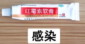 红霉素软膏快递到法国